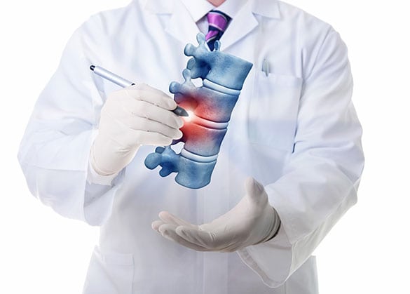 epidural injections los angeles pain associates 2 - Epidural Injections