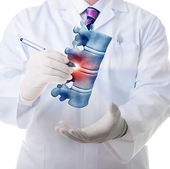 spinal injuries los angeles pain associates 4 - Spinal Injuries