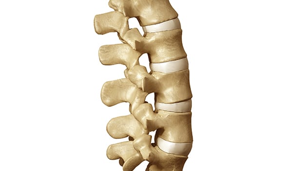 vertebral compression los angeles pain associates - Vertebral Compression